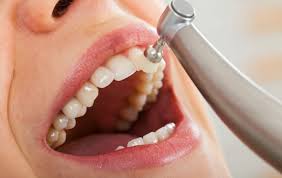 Dental Emergencies