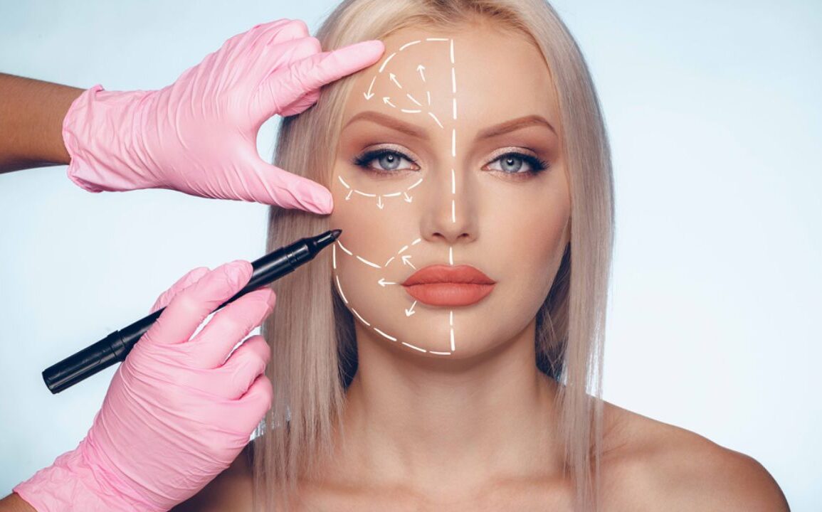 Cosmetic Surgery