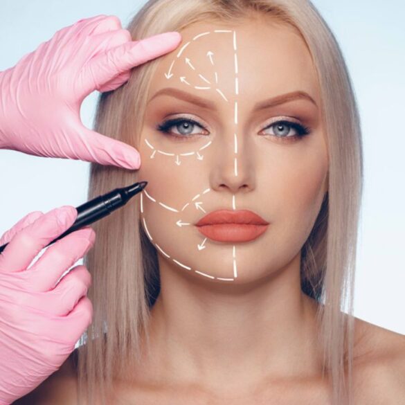 Cosmetic Surgery