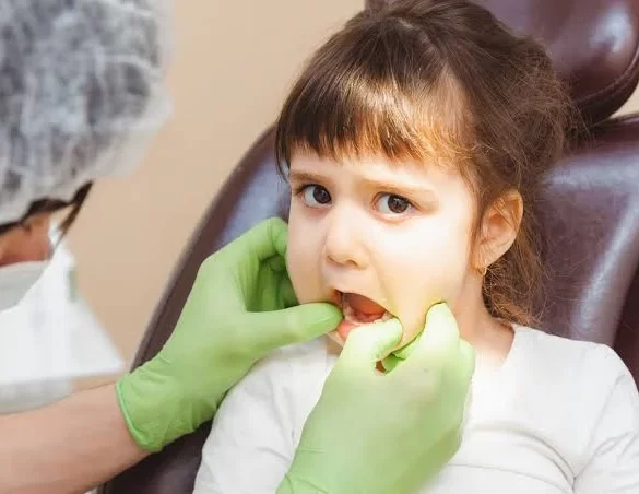 Common Dental Emergencies in Children and How Parents Should Respond