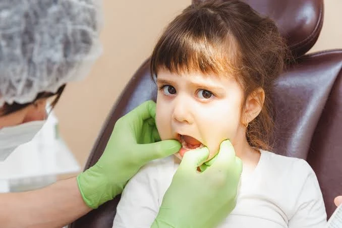 Common Dental Emergencies in Children and How Parents Should Respond