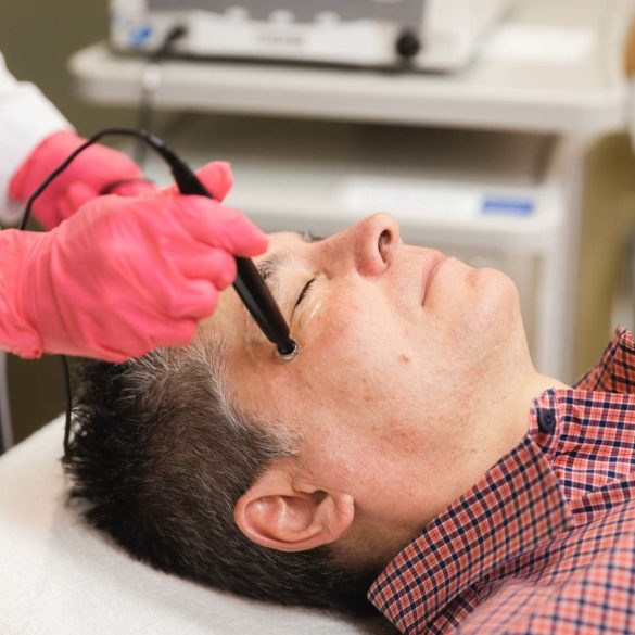 ThermiSmooth and the Science of Radiofrequency Skin Care