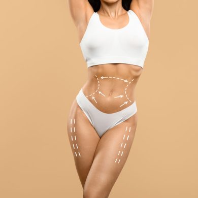Liposuction