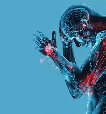 Nerve Pain